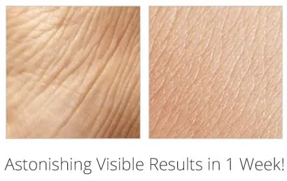 Treme Anti Wrinkle Cream 12